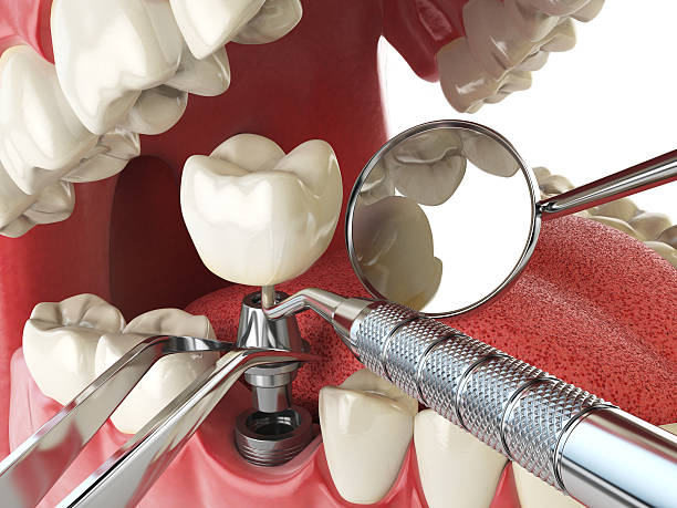 Best Walk-In Emergency Dental Services in Spring Grove, PA